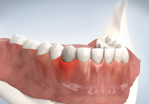 3D-Animation